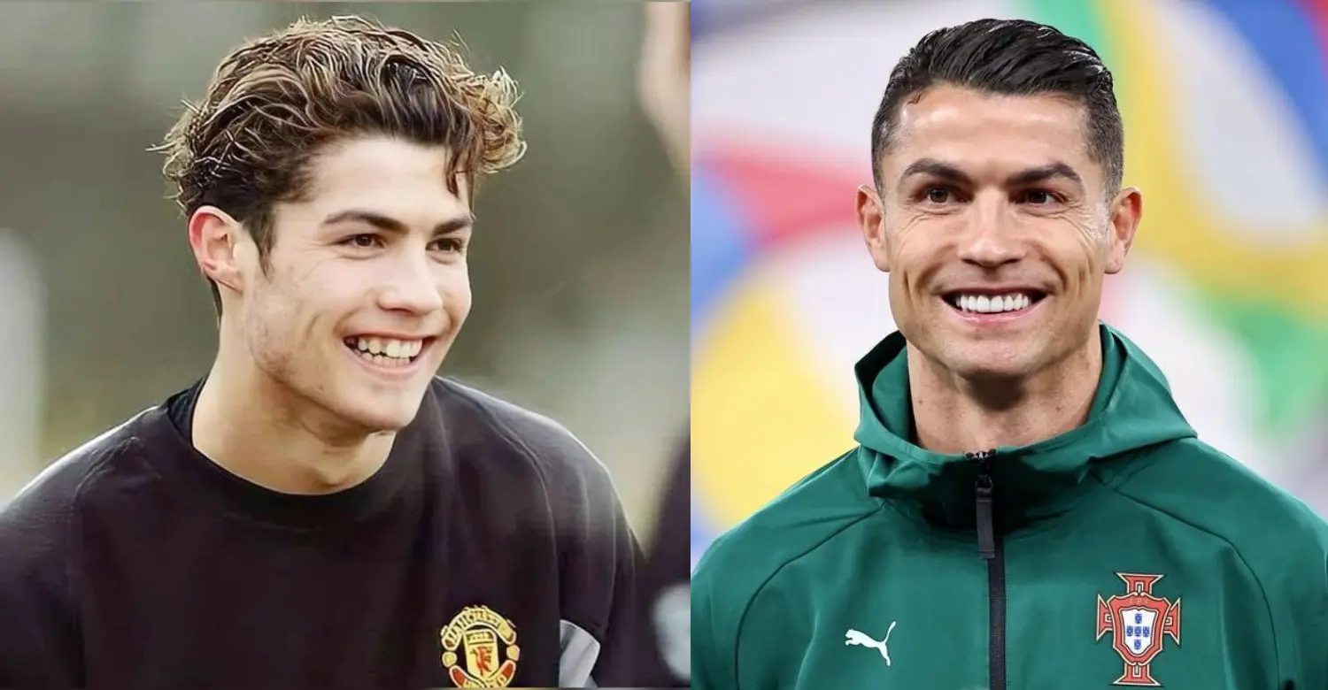 Cristiano Ronaldo teeth